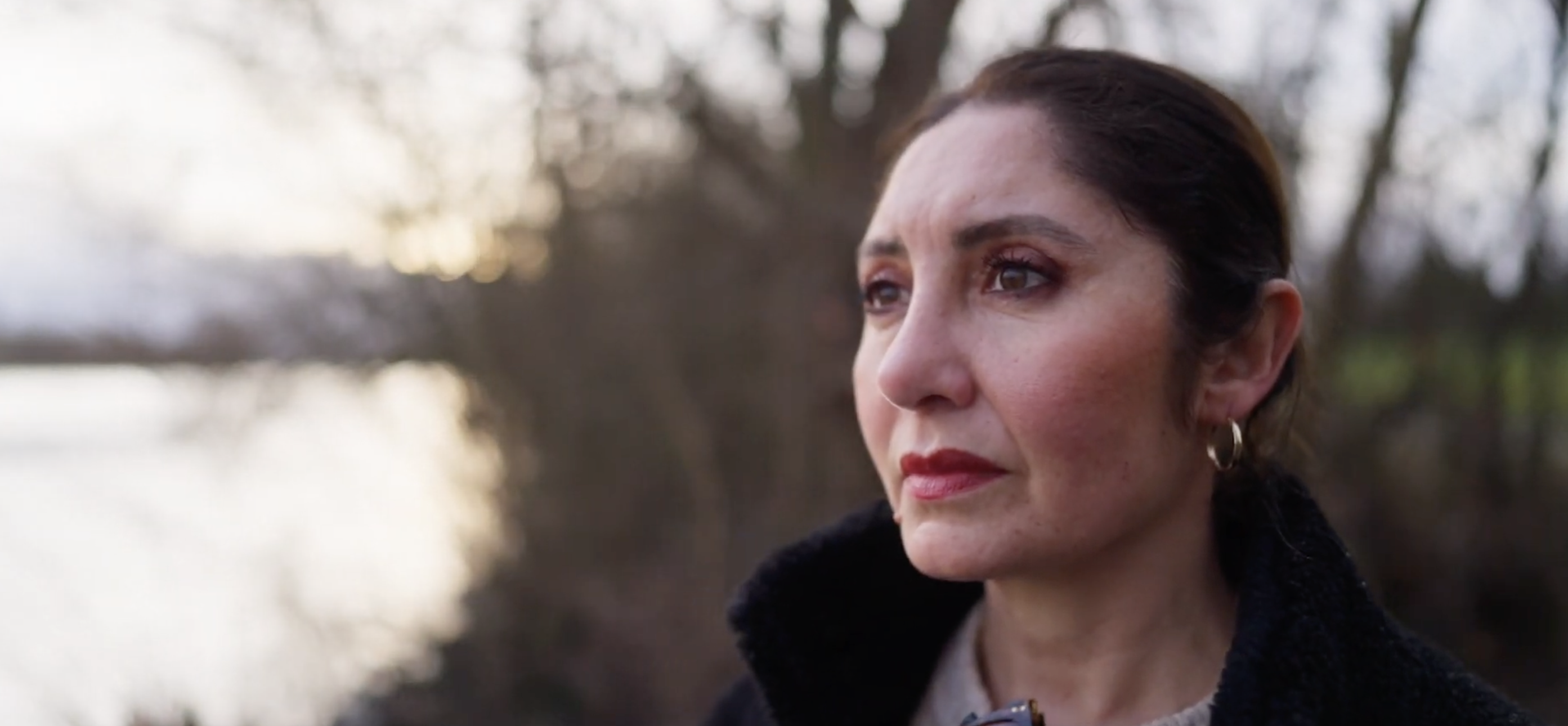 Dilek, a mother of two from Germany who suffers from the rare chronic liver disease.