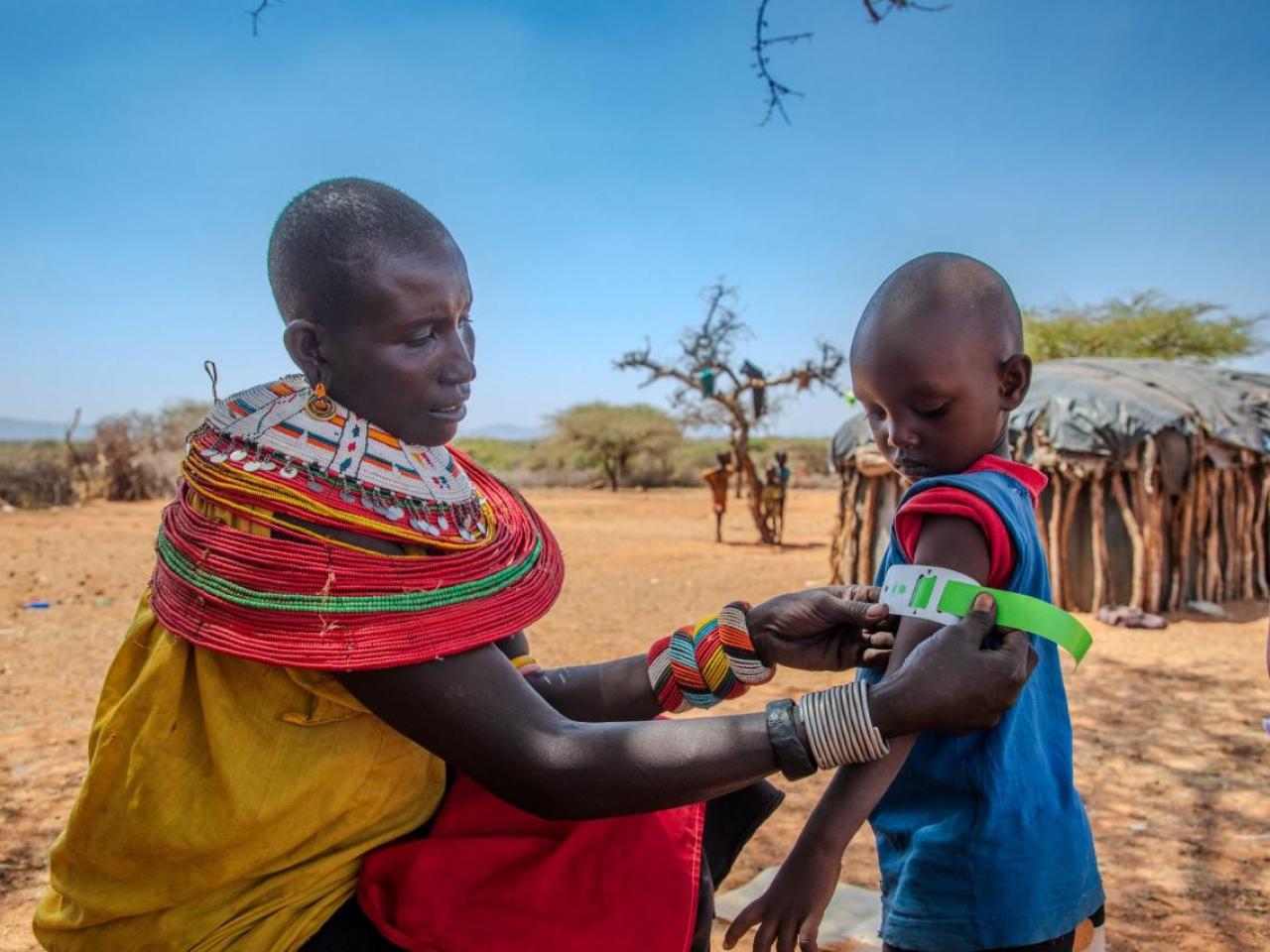 Rashei's mother checks his MUAC measurement after treatment. 