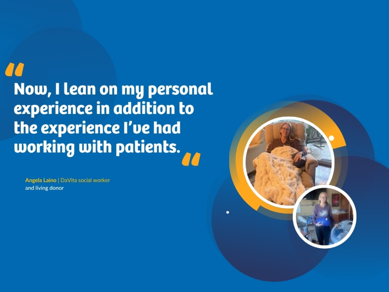 "Now, I lean on my personal experience in addition to the experience l've had working with patients." Angela Laino | DaVita social worker and living donor