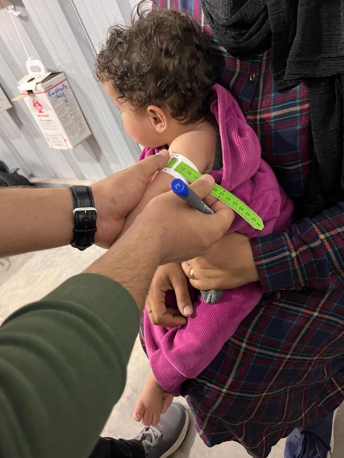 A baby is tested for malnutrition with a mid-upper arm circumference band tool. 