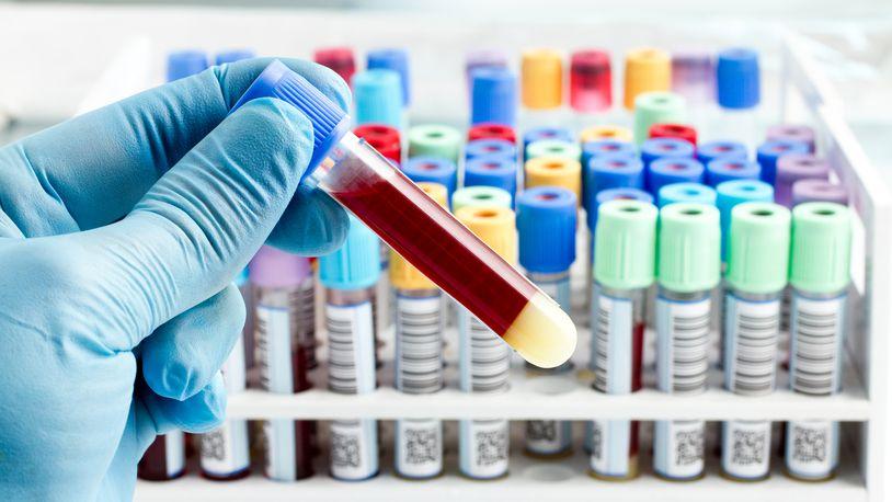 Gloved hand holding a test tube with a blood sample.