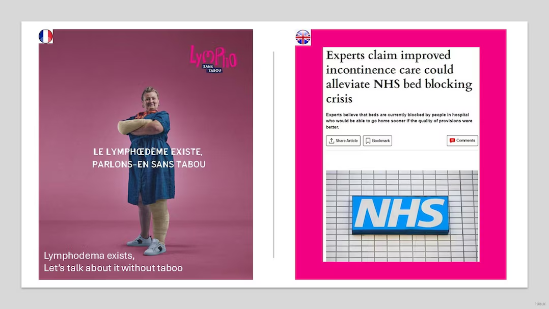 Lymphodema exists, Let's talk about it without taboo
