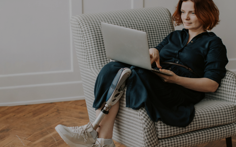 a person lounging in a chair a laptop in their lap, they have one prosthetic leg