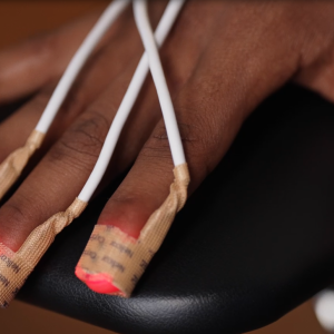 Image of a patient's hand connected to a Medtronic pulse oximeter