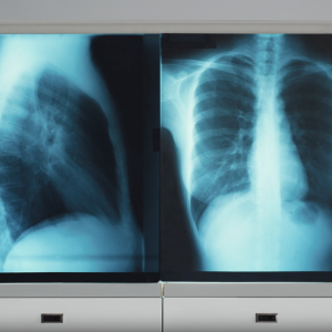 image of an x-ray