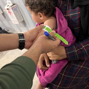 A baby is tested for malnutrition with a mid-upper arm circumference band tool. 