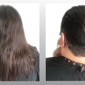 Before and after photo of John Doherty (rear view)