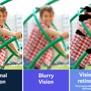 three side by side images of a child on a playset one labeled normal vision one blurry vision and one vision with retinopathy. Each image is altered to match how it might appear to someone with those conditions.