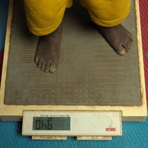 A young child is screened for malnutrition in South Sudan after crossing the border.