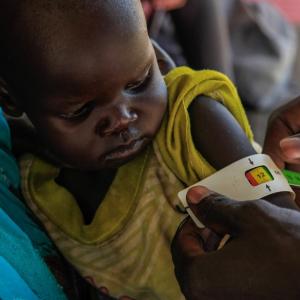 Action Against Hunger is helping children in Sudan and refugees in South Sudan through malnutrition prevention and treatment. / Photo by Lys Arango 