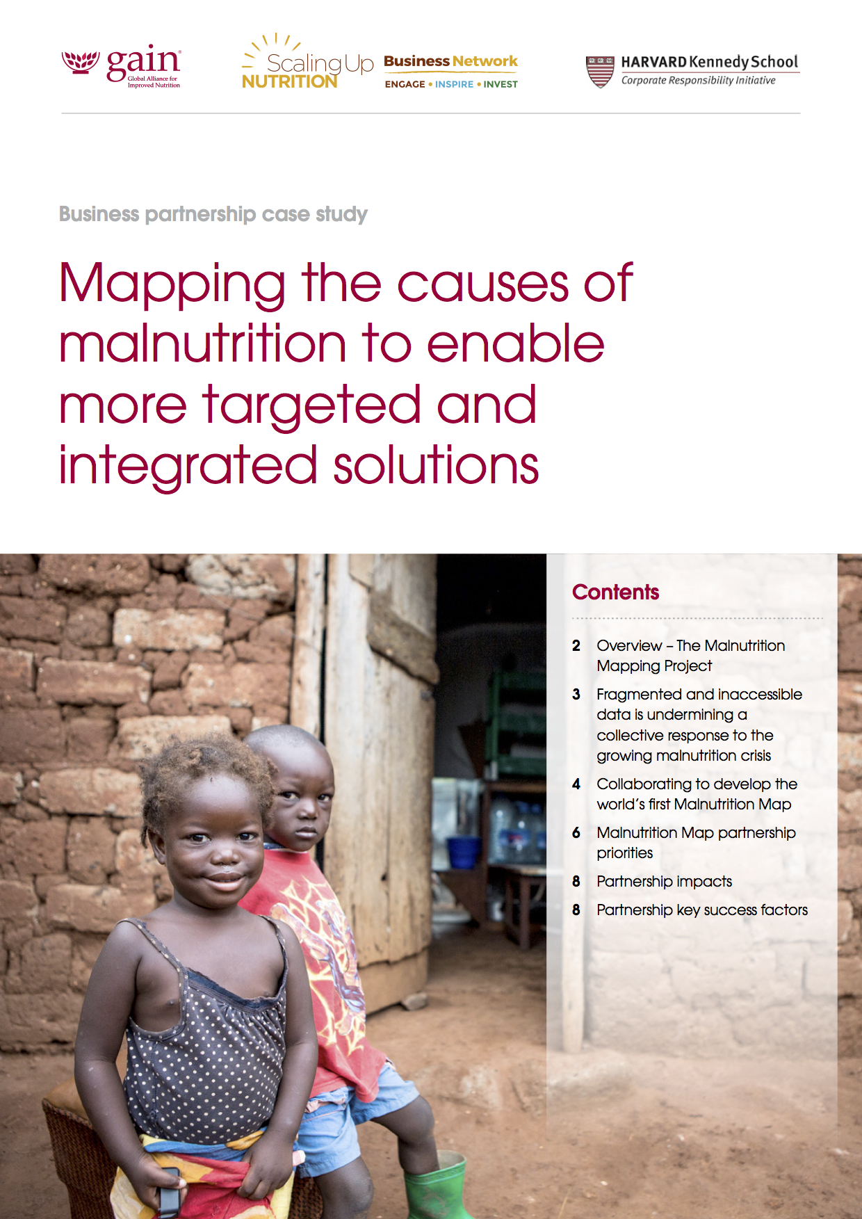 Kwashiorkor case study picture