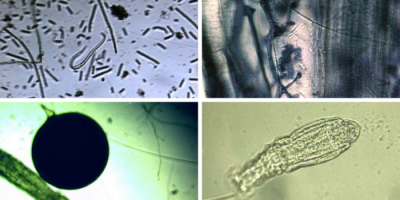 These pictures, along with the featured image of this article, illustrate some of the diversity of microbes in the soil, which provide nutrients and water (sometimes by “pooping them out”) to plants in exchange for carbon.