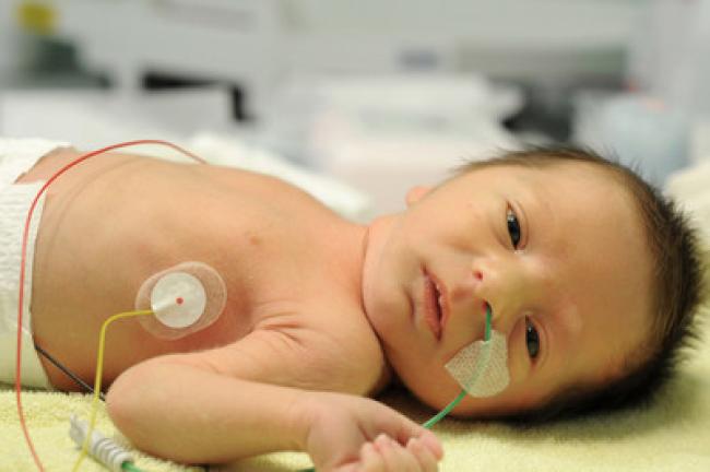 Photo of an infant in an Intensive Care Unit.