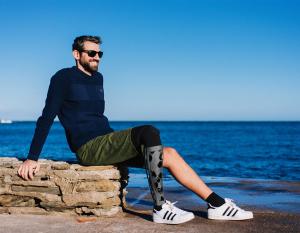 With Print My Leg, Christophe Debard wants to elevate the aesthetics of prosthetic limbs, creating an opportunity for creativity and personal expression.