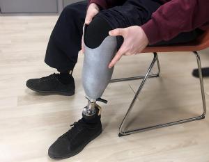 ProsFit founders Christopher and Alan Hutchison have set an ambitious goal of creating 3D printed prosthetic sockets for 20 million amputees.