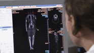 VIDEO | Fit for the Future: Philips Reinvents Patient-centric Healthcare with the Cloud